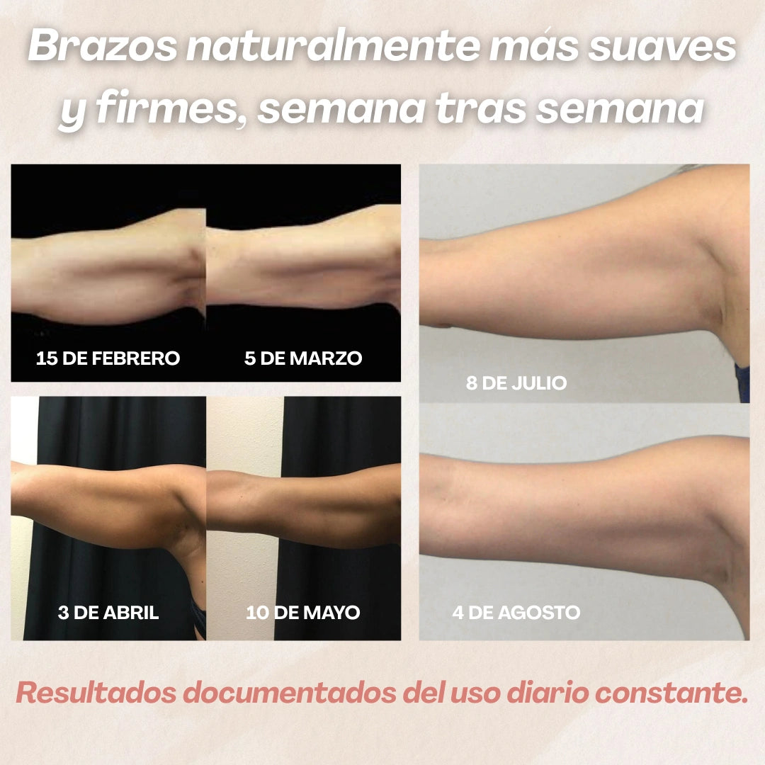 Mangas moldeadoras 3D — uso continuado